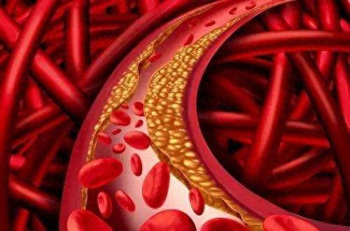 补硒能消除斑块吗女性（补硒能祛斑吗）-硒宝网