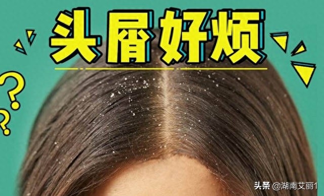 补硒可以祛头屑吗女性(硒能治脱发吗)-硒宝网