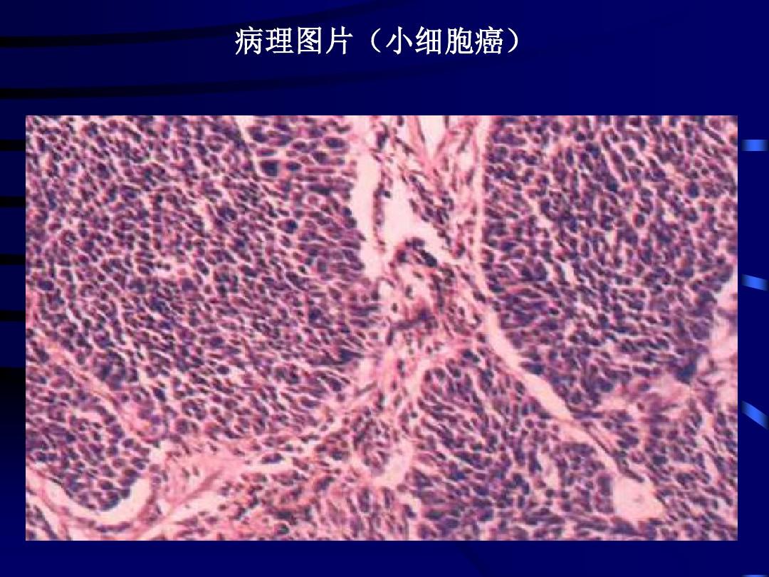 哪些恶性肿瘤不可补硒（肿瘤恶性补硒可以治愈吗）-硒宝网
