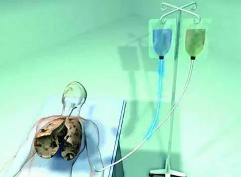 肺癌后期补硒有作用吗(肺癌补硒吃什么药)-硒宝网