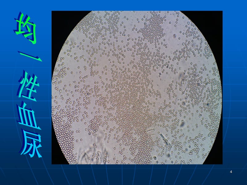 补硒后尿道有什么反应（补硒后尿道有什么反应）-硒宝网