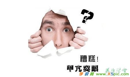 甲亢眼病突眼补硒药物(甲亢突眼硒酵母)-硒宝网