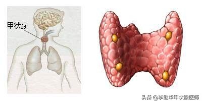 预防痛风你试过补硒吗（硒对痛风有治疗效果吗）-硒宝网