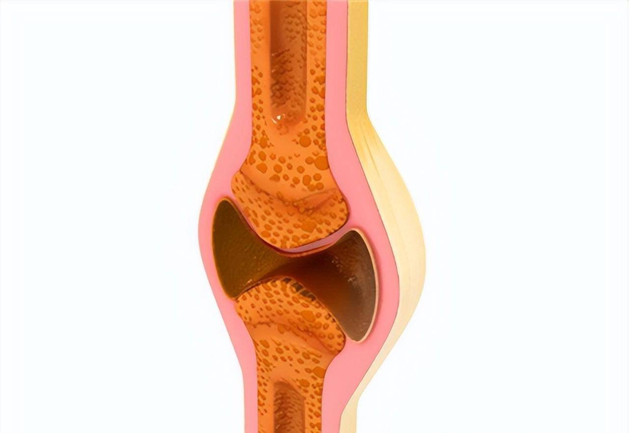 可以食物补硒抗炎症吗(吃硒可以增强抵抗力吗)-硒宝网