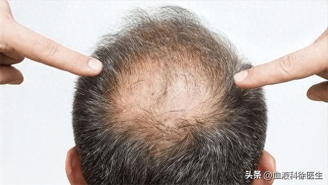 怎样补硒最健康的食物(补食物健康硒的作用)-硒宝网