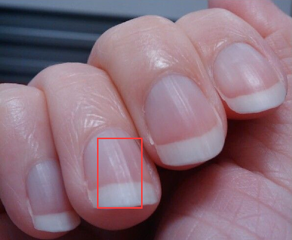 乳腺和肝脏要补那种硒(乳腺和肝脏要补那种硒)-硒宝网