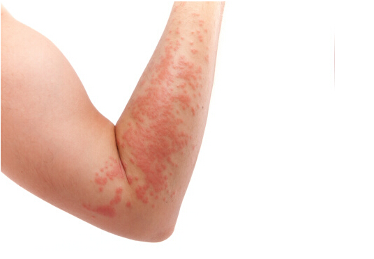 乳腺和肝脏要补那种硒(乳腺和肝脏要补那种硒)-硒宝网