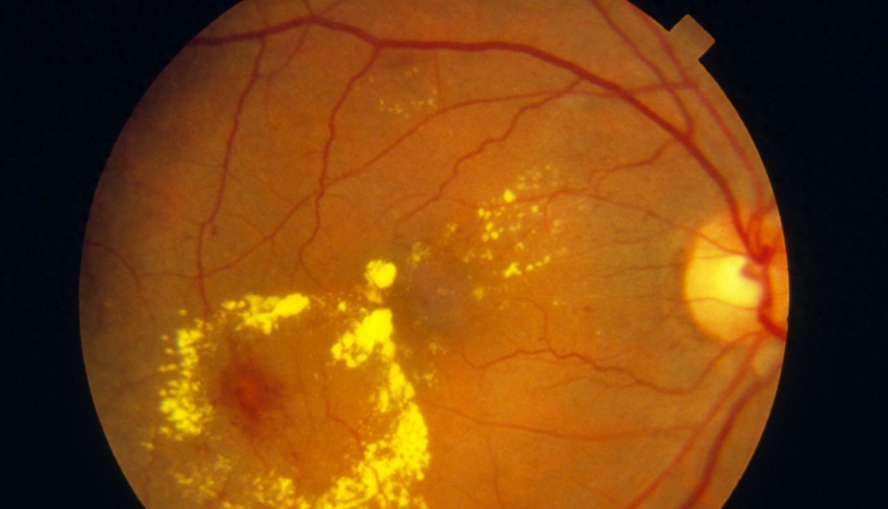 补硒从此远离口腔溃疡(口腔溃疡吃硒酵母片)-硒宝网