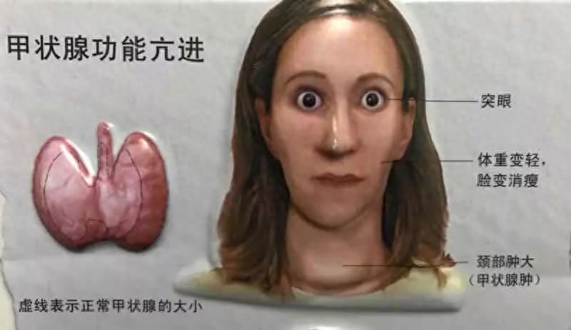 补硒从此远离口腔溃疡(口腔溃疡吃硒酵母片)-硒宝网