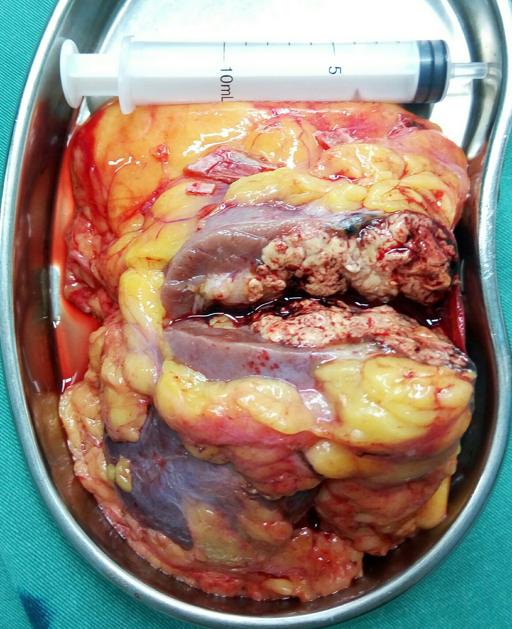 放化疗患者需要补硒吗(放化疗患者需要补硒吗)-硒宝网