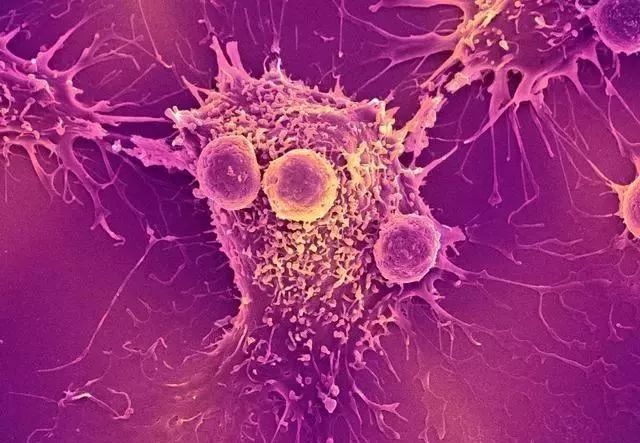 肿瘤手术后可以补硒吗（肿瘤手术后可以补硒吗）-硒宝网