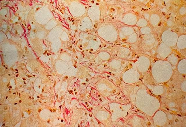 鹅蛋怎么吃补硒效果好（鹅蛋补硒吗）-硒宝网