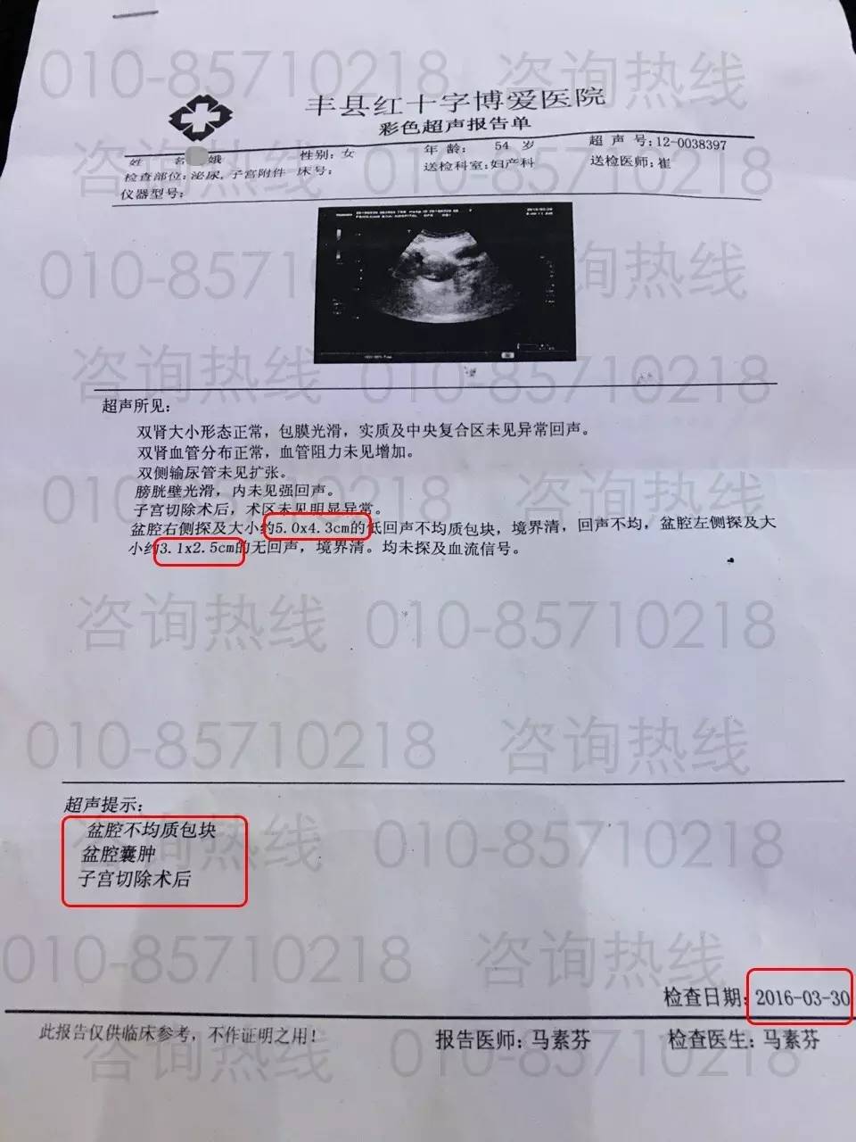 补硒真的让肿瘤消失了(肿瘤病人补硒疗效案例)-硒宝网