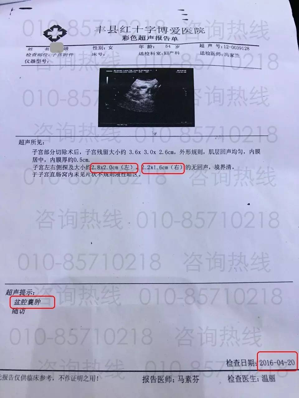 补硒真的让肿瘤消失了(肿瘤病人补硒疗效案例)-硒宝网