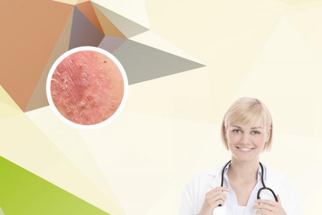 银屑病人每天补硒多少(每天补充硒)-硒宝网