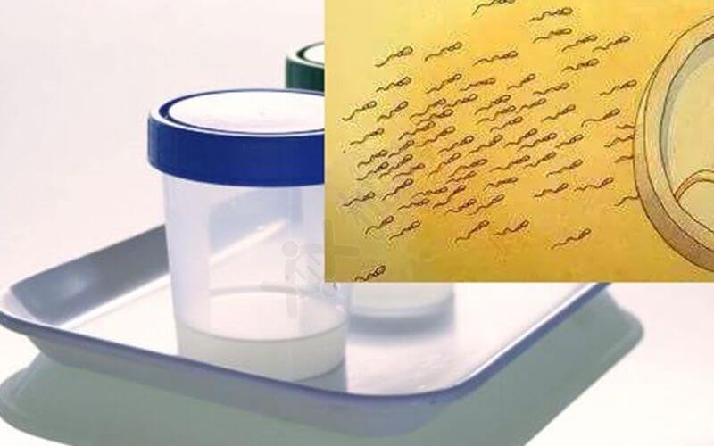 补硒治疗植物神经紊乱(植物神经功能条乱可以补硒吗)-硒宝网