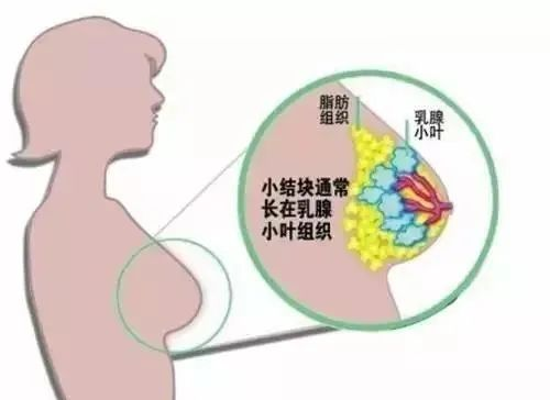 补硒对女性乳腺有好处吗(硒对乳房疾病有什么作用)-硒宝网