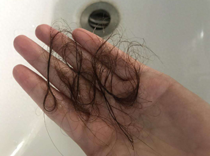 硒补多了人体有啥反应（人体补硒的药物有哪些）-硒宝网