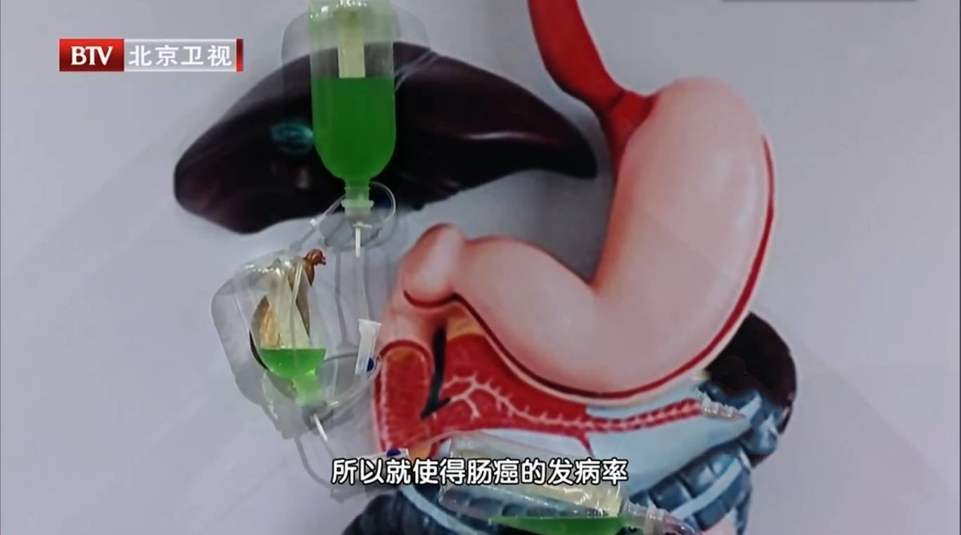 肠息肉补硒有什么好处（切除了肠息肉能吃硒元素吗）-硒宝网