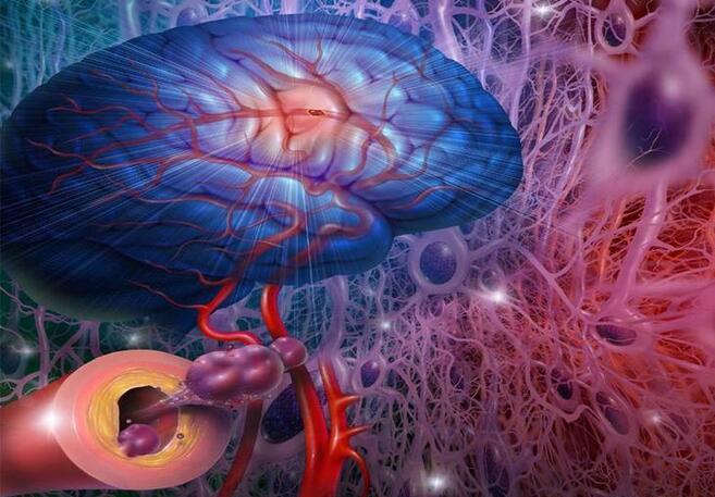 天天补硒能否治脑血栓(补硒对脑梗有哪些作用)-硒宝网