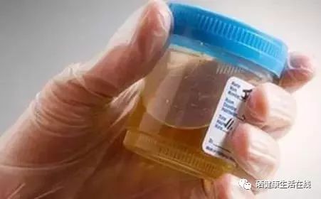 天天补硒能否治脑血栓(补硒对脑血栓有效果吗)-硒宝网