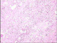 胆囊壁毛糙补硒行不行（胆壁毛糙吃中药还是西药治疗快）-硒宝网