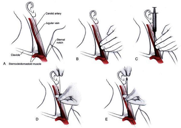 生殖疱疹能补硒吗女性（能补女性疱疹生殖硒吗）-硒宝网
