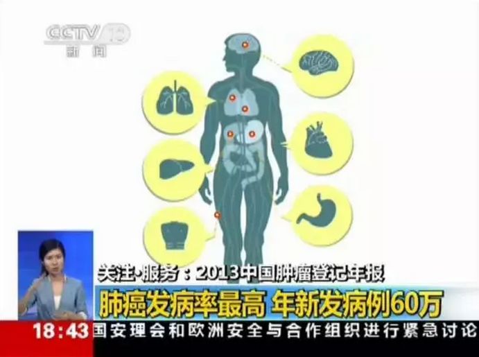 高危人群补硒預防肺癌(肺癌补硒)-硒宝网