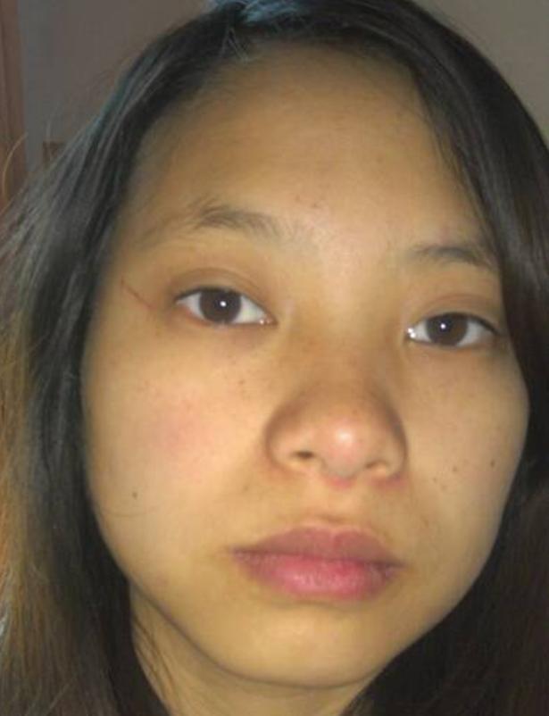 胃溃疡能吃补硒的食物（胃溃疡可以吃硒酵母片吗）-硒宝网