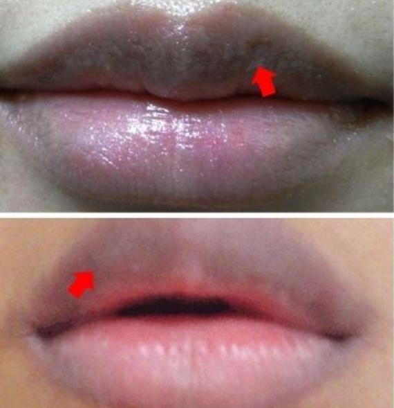 胃溃疡能吃补硒的食物（胃溃疡可以吃硒酵母片吗）-硒宝网