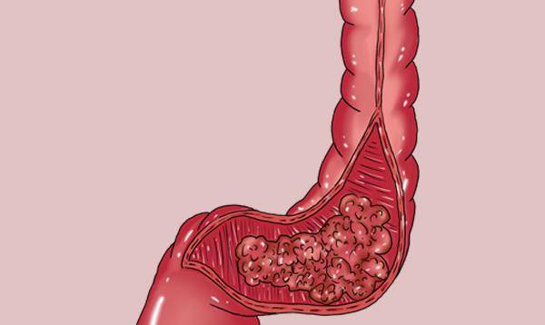 补硒对眼晴有哪些好处(眼睛补硒有什么好处)-硒宝网