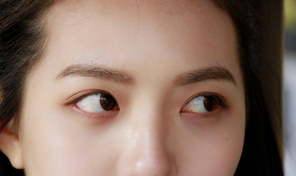 补硒对眼晴有哪些好处(眼睛补硒有什么好处)-硒宝网