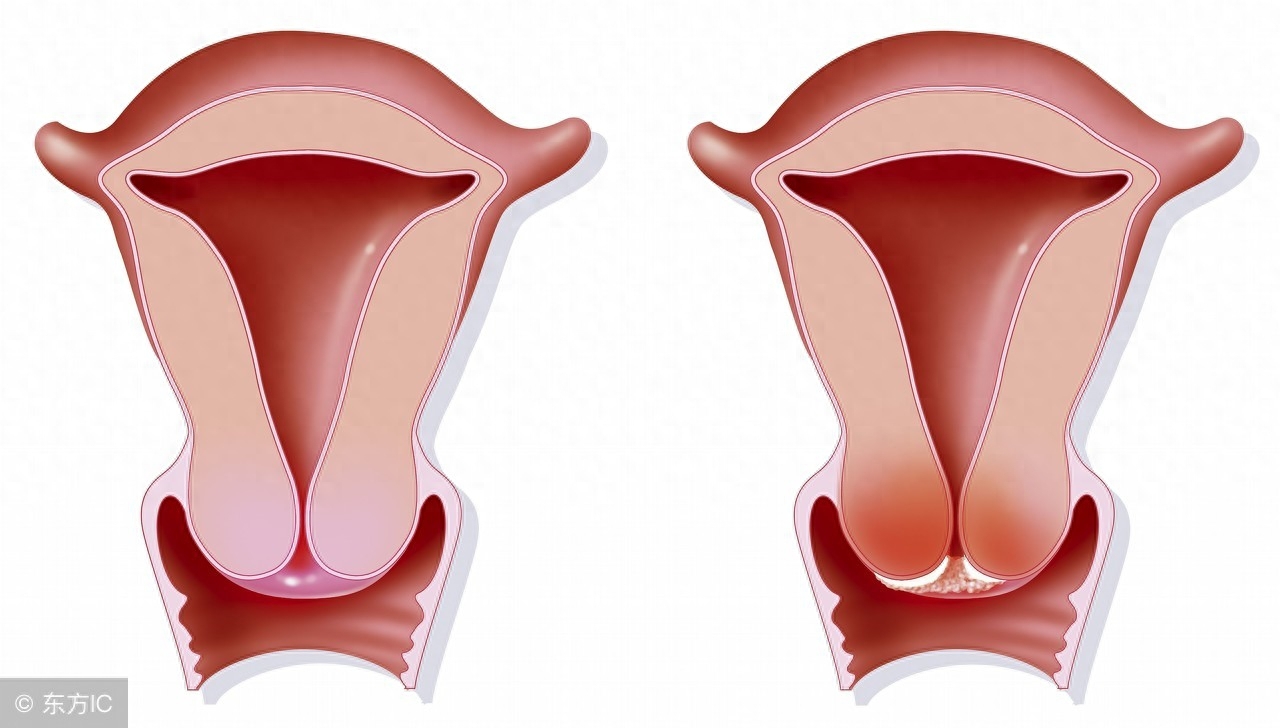 补硒对宫颈有什么好处（那种硒对宫颈好）-硒宝网