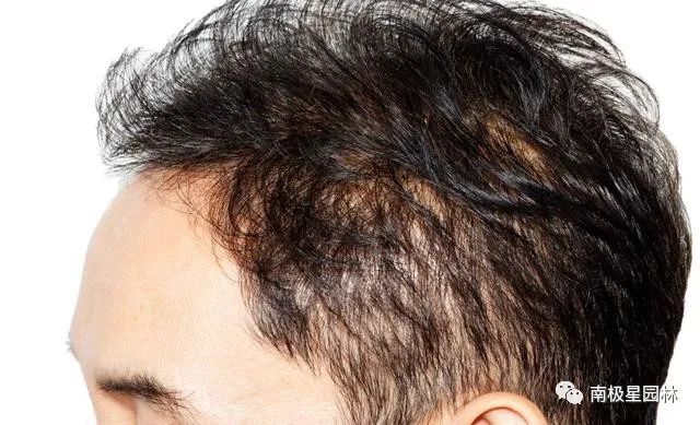 补硒能引起胃肠不适吗(肠胃不好吃硒管用吗)-硒宝网