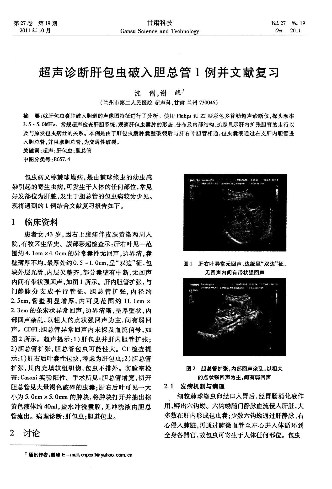 甲状腺弥漫性损伤补硒（甲状腺弥漫应该吃什么）-硒宝网