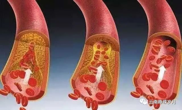补锌和补硒用什么方法(补锌和补硒用什么方法)-硒宝网