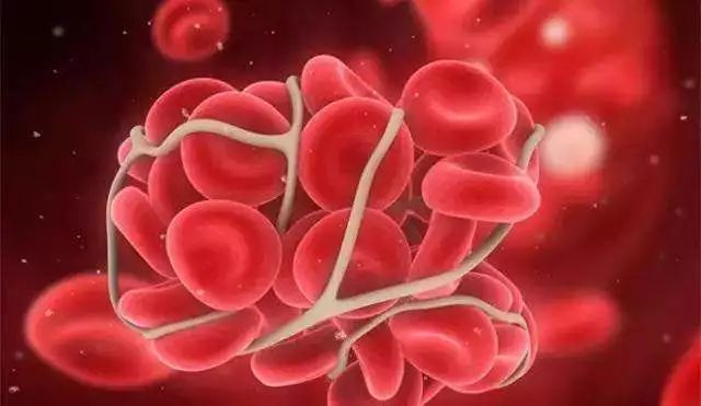 防癌变息肉补硒要多久(硒对息肉的作用)-硒宝网