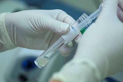 孕前检查医生叫我补硒(孕期补硒)-硒宝网