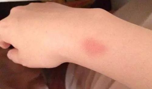 补硒药品会推迟月经吗（补硒药品会推迟月经吗）-硒宝网