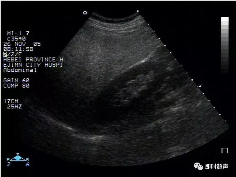 补硒能修复胰岛功能吗(能修复胰岛功能的药物)-硒宝网