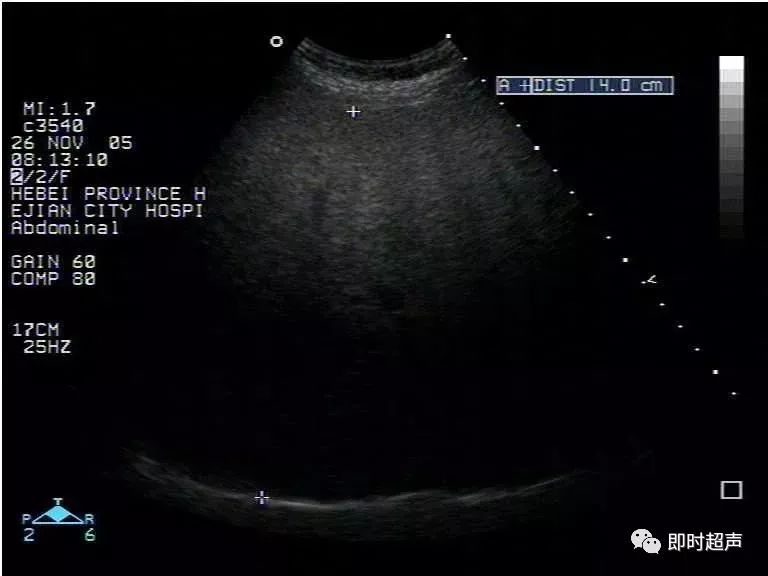 补硒能修复胰岛功能吗(能修复胰岛功能的药物)-硒宝网