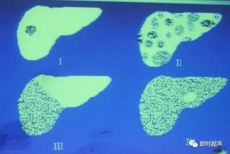 补硒能修复胰岛功能吗(能修复胰岛功能的药物)-硒宝网