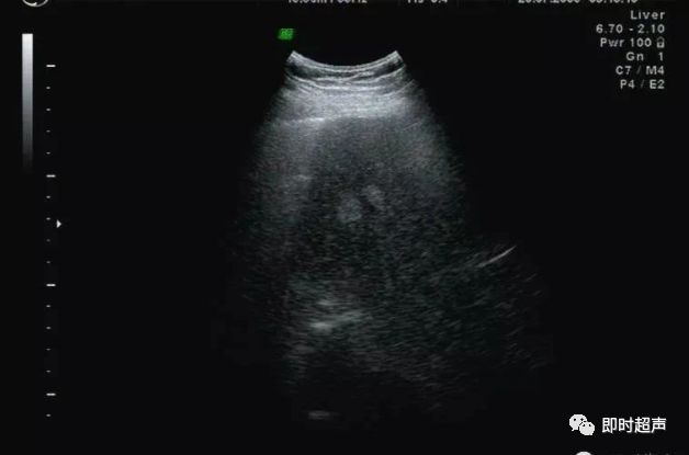 补硒能修复胰岛功能吗(能修复胰岛功能的药物)-硒宝网