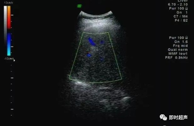 补硒能修复胰岛功能吗(能修复胰岛功能的药物)-硒宝网