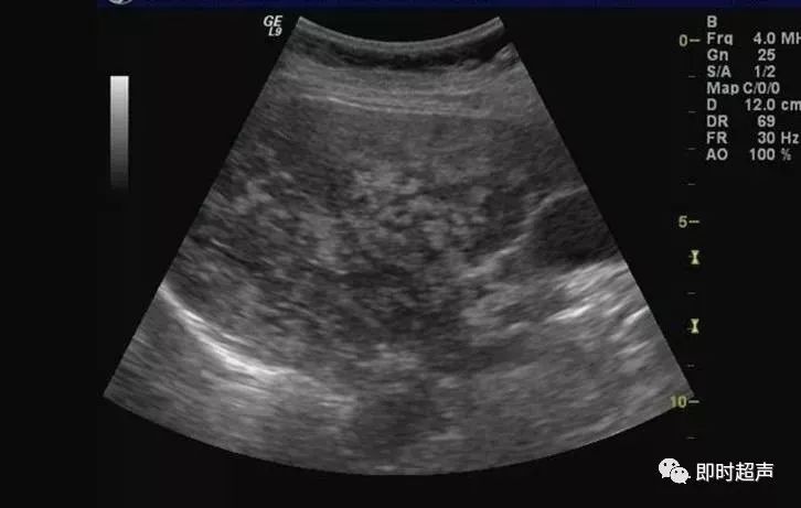 补硒能修复胰岛功能吗(能修复胰岛功能的药物)-硒宝网