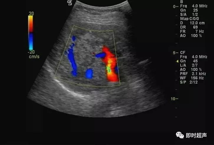 补硒能修复胰岛功能吗(能修复胰岛功能的药物)-硒宝网