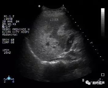 补硒能修复胰岛功能吗(能修复胰岛功能的药物)-硒宝网
