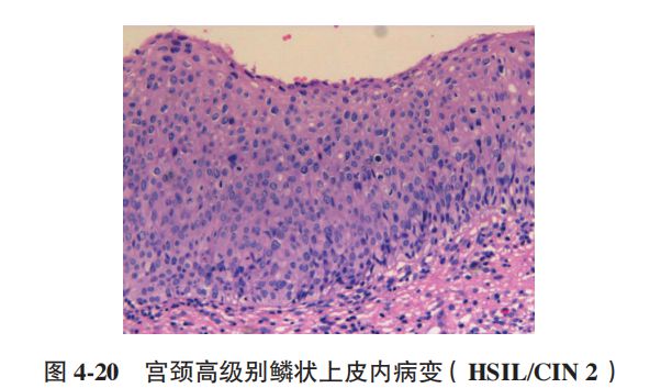 补硒为什么感觉宫颈疼(补宫颈的食物)-硒宝网