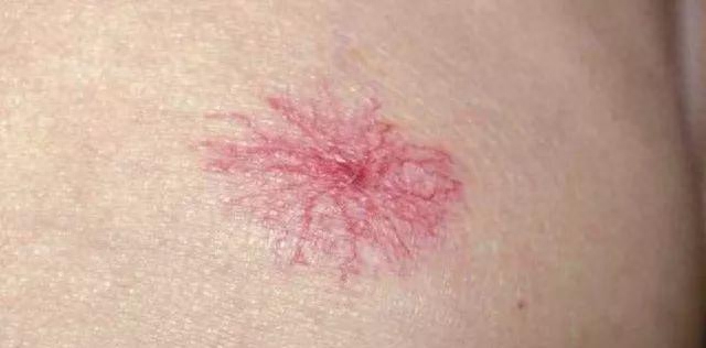 过量补硒对肝脏的危害(肝脏过量危害补硒的药物)-硒宝网