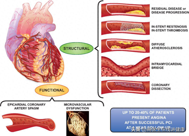 冠心病补哪个牌子的硒(硒对冠心病有什么好处)-硒宝网